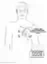 Fig. 01 - SYSTEMS AND METHODS FOR ASSESSING AND REPROGRAMMING SENSING VECTORS FOR USE WITH AN IMPLANTABLE CARDIAC RHYTHM MANAGEMENT DEVICE
