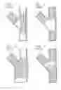 Fig. 02 - CATHETER ASSEMBLY AND METHOD FOR TREATING BIFURCATIONS
