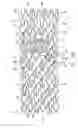 Fig. 09 - CATHETER ASSEMBLY AND METHOD FOR TREATING BIFURCATIONS