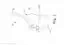 Fig. 07 - Catheter-Based Heart Valve Therapy System with Sizing Balloon