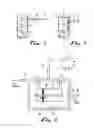 Fig. 03 - TRACHEAL CATHETER AND PROSTHESIS AND METHOD OF RESPIRATORY SUPPORT OF A PATIENT