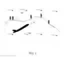 Fig. 02 - Object speed weighted motion compensated interpolation