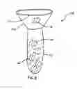Fig. 06 - Odor containment