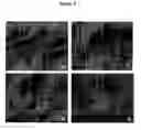 Fig. 03 - COMPOSITIONS AND METHODS USING STEM CELLS IN CUTANEOUS WOUND HEALING