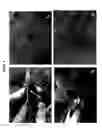 Fig. 05 - COMPOSITIONS AND METHODS USING STEM CELLS IN CUTANEOUS WOUND HEALING