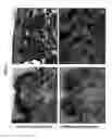 Fig. 08 - COMPOSITIONS AND METHODS USING STEM CELLS IN CUTANEOUS WOUND HEALING
