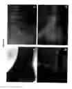 Fig. 09 - COMPOSITIONS AND METHODS USING STEM CELLS IN CUTANEOUS WOUND HEALING