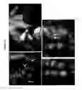 Fig. 17 - COMPOSITIONS AND METHODS USING STEM CELLS IN CUTANEOUS WOUND HEALING