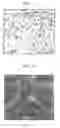 Fig. 03 - Nanosphere/microsphere delivery system for the treatment of spinal cord injury