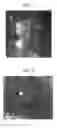 Fig. 06 - Nanosphere/microsphere delivery system for the treatment of spinal cord injury