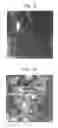 Fig. 07 - Nanosphere/microsphere delivery system for the treatment of spinal cord injury