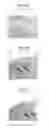 Fig. 06 - METHOD FOR RESTORING MISSING TOOTH AND METHOD FOR PRODUCING RESTORATIVE MATERIAL