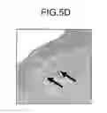 Fig. 07 - METHOD FOR RESTORING MISSING TOOTH AND METHOD FOR PRODUCING RESTORATIVE MATERIAL