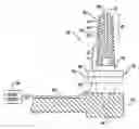 Fig. 01 - Sinus lift implant