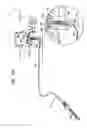 Fig. 07 - Sinus lift implant