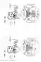 Fig. 08 - Sinus lift implant