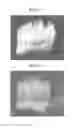 Fig. 04 - Methods for forming tooth root and periodontal tissue unit, and regenerated tooth