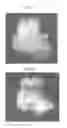 Fig. 05 - Methods for forming tooth root and periodontal tissue unit, and regenerated tooth