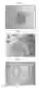 Fig. 06 - Methods for forming tooth root and periodontal tissue unit, and regenerated tooth