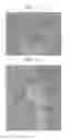 Fig. 07 - Methods for forming tooth root and periodontal tissue unit, and regenerated tooth