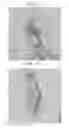 Fig. 08 - Methods for forming tooth root and periodontal tissue unit, and regenerated tooth