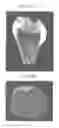 Fig. 16 - Methods for forming tooth root and periodontal tissue unit, and regenerated tooth