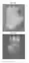 Fig. 20 - Methods for forming tooth root and periodontal tissue unit, and regenerated tooth