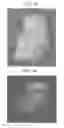 Fig. 22 - Methods for forming tooth root and periodontal tissue unit, and regenerated tooth
