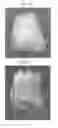 Fig. 23 - Methods for forming tooth root and periodontal tissue unit, and regenerated tooth