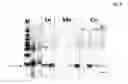 Fig. 06 - PACAP AS A MARKER FOR CANCER