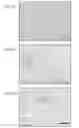 Fig. 04 - Biomarkers and methods for determining disease progression in nonalcoholic steatohepatitis (NASH)