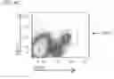 Fig. 09 - Biomarkers and methods for determining disease progression in nonalcoholic steatohepatitis (NASH)