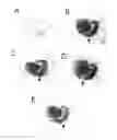 Fig. 01 - In Vitro Model of Focal Ischemia