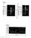 Fig. 06 - Methods and compositions for performing low background multiplex nucleic acid amplification reactions