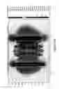Fig. 20 - Superconducting magnet systems