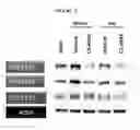 Fig. 45 - Biomarkers for predicting the sensitivity and response of protein kinase CK2-mediated diseases to CK2 Inhibitors