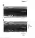 Fig. 04 - Compositions and methods to treat cardiac diseases