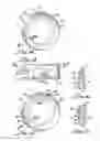 Fig. 07 - Implantable access port device and attachment system
