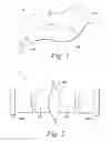Fig. 02 - Non-rigid surgical retractor