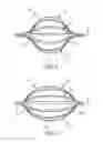 Fig. 09 - Bendable catheter arms having varied flexibility