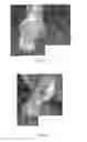 Fig. 02 - THERAPEUTIC COMPOSITIONS, DEVICES AND METHODS FOR OBSERVING TREATED TISSUES