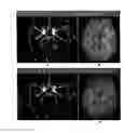 Fig. 01 - Echo-specific K-space reordering approach to compatible dual-echo arteriovenography