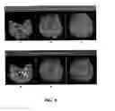 Fig. 06 - Echo-specific K-space reordering approach to compatible dual-echo arteriovenography