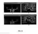Fig. 07 - Echo-specific K-space reordering approach to compatible dual-echo arteriovenography