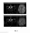 Fig. 08 - Echo-specific K-space reordering approach to compatible dual-echo arteriovenography