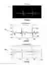 Fig. 06 - METHOD AND APPARATUS FOR DETERMINING A HEART PERIOD FROM AN ECG WAVEFORM USING IMAGE REPRESENTATION OF ECG