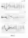 Fig. 05 - SYSTEMS AND METHODS FOR USE WITH SUBCUTANEOUS IMPLANTABLE MEDICAL DEVICES FOR DETECTING ELECTRODE/TISSUE CONTACT PROBLEMS