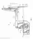 Fig. 02 - Method for minimally invasive surgery