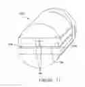 Fig. 10 - Radio-frequency tissue welder with polymer reinforcement