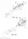 Fig. 09 - Circular thermal capsulotomy tool and system